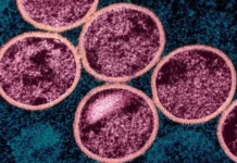 DF tem 80 doses de vacina contra mpox; veja quem pode se imunizar