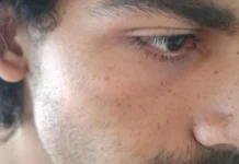 Estudante da UnB é agredido dentro de supermercado