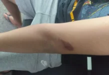 Trio de adolescentes rouba e agride vítima no Riacho Fundo 2